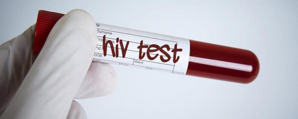 Coronavirus: que lecciones nos dejó el sida, la “peor pandemia de finales del siglo XX”, para hacer frente al covid-19