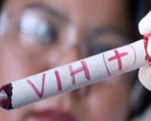 Logran eliminar el VIH en seis pacientes gracias al trasplante de células madre